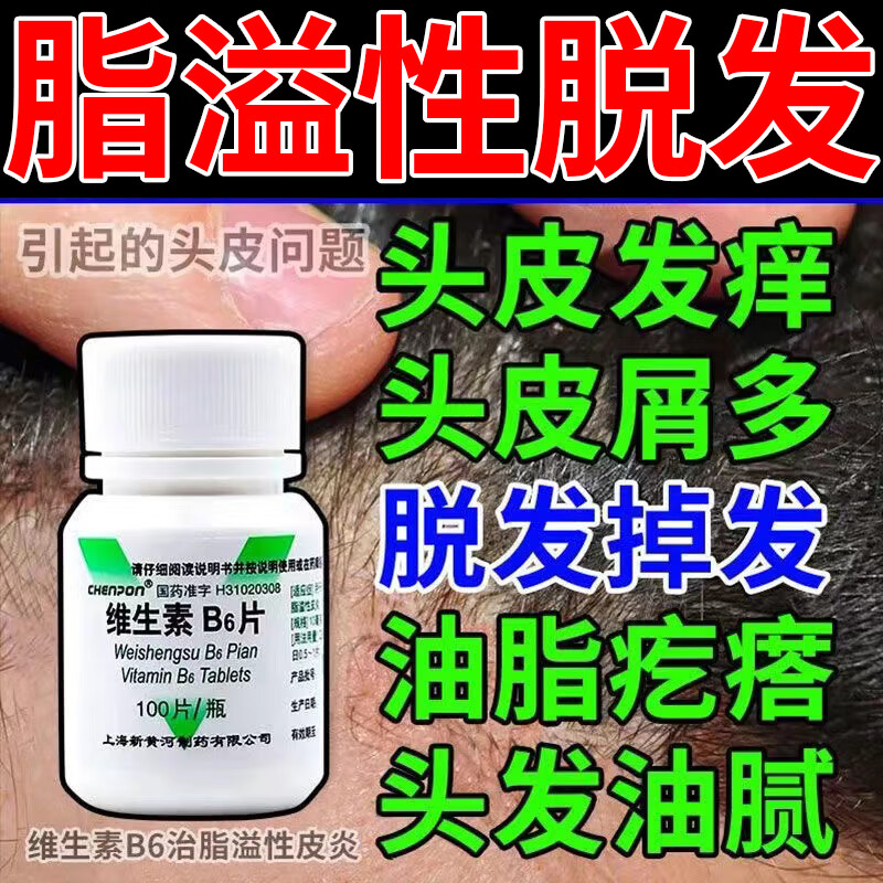 维生素b6 治脂溢性脱发掉发 脂溢性皮炎引起头皮痒红斑头发油头皮屑掉