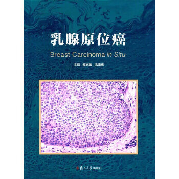 乳腺原位癌 邵志敏,沈镇宙【上新】