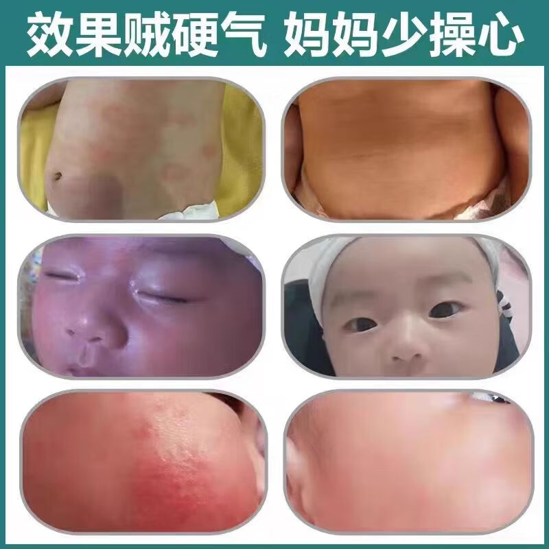 贝璞花抑菌膏婴亲霜老款抑菌霜草本婴儿湿痒专用奶藓红屁屁膏宝宝红痒霜 90g 3瓶 常规装 贝璞花抑菌膏