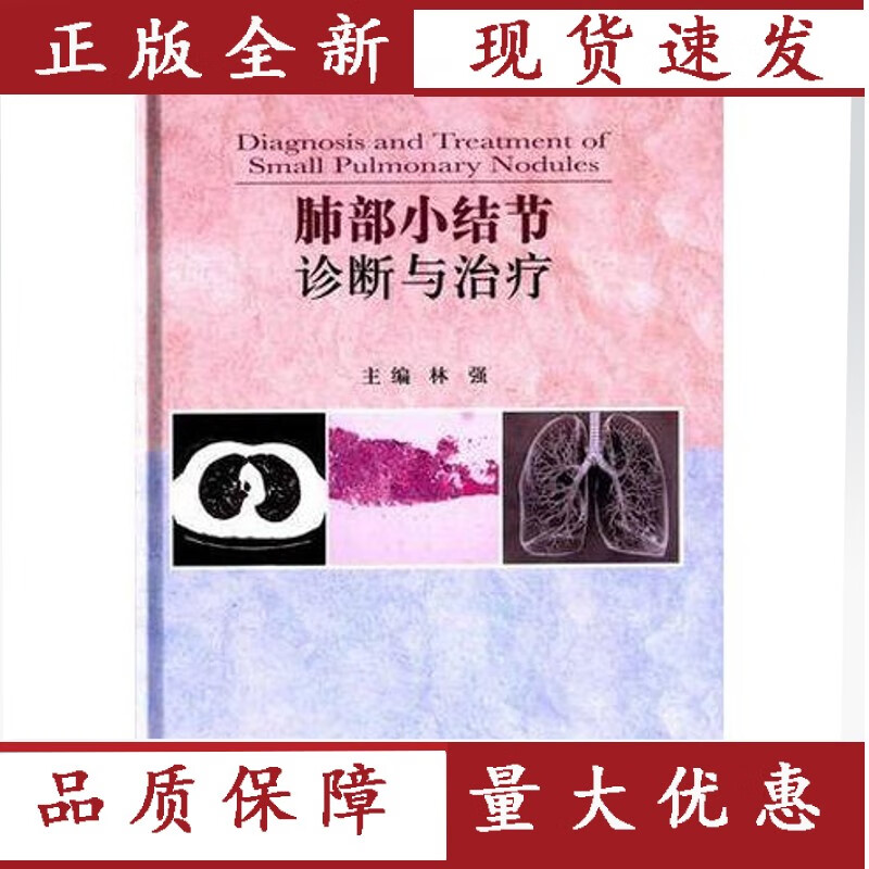 肺部小结节诊断与治疗