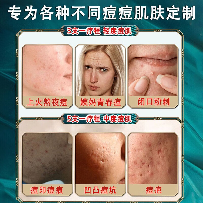 南京同仁堂祛痘膏去痘印痘疤痘坑痘痘肌修护男女学生青春红肿痘闭口粉刺芦荟胶祛痘印凹洞百幽草