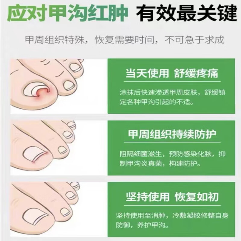 必力欣甲立舒必力欣甲立舒恩宝佳必力欣甲立舒甲沟套装 1盒装 装 1