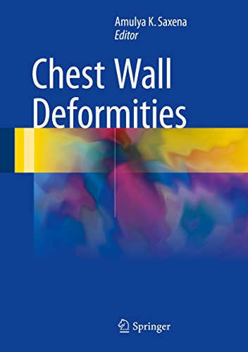 预订 chest wall deformities