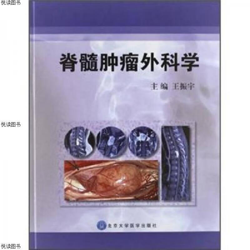 脊髓肿瘤外科学(全新未拆封)