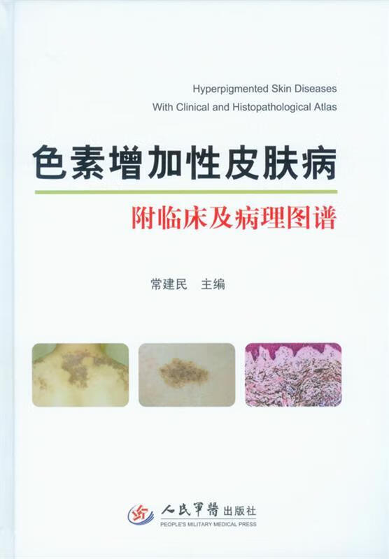 色素增加性皮肤病-附临床及病理图谱