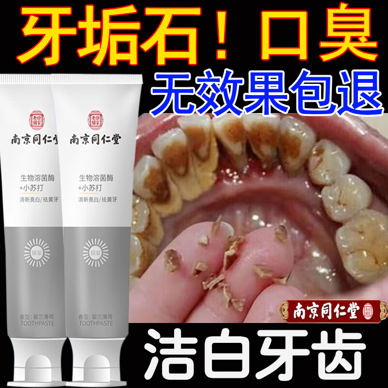 UNIO南京同仁堂小苏打牙膏去牙渍茶烟渍口臭牙垢牙斑清洁异味口气100g属于什么档次？