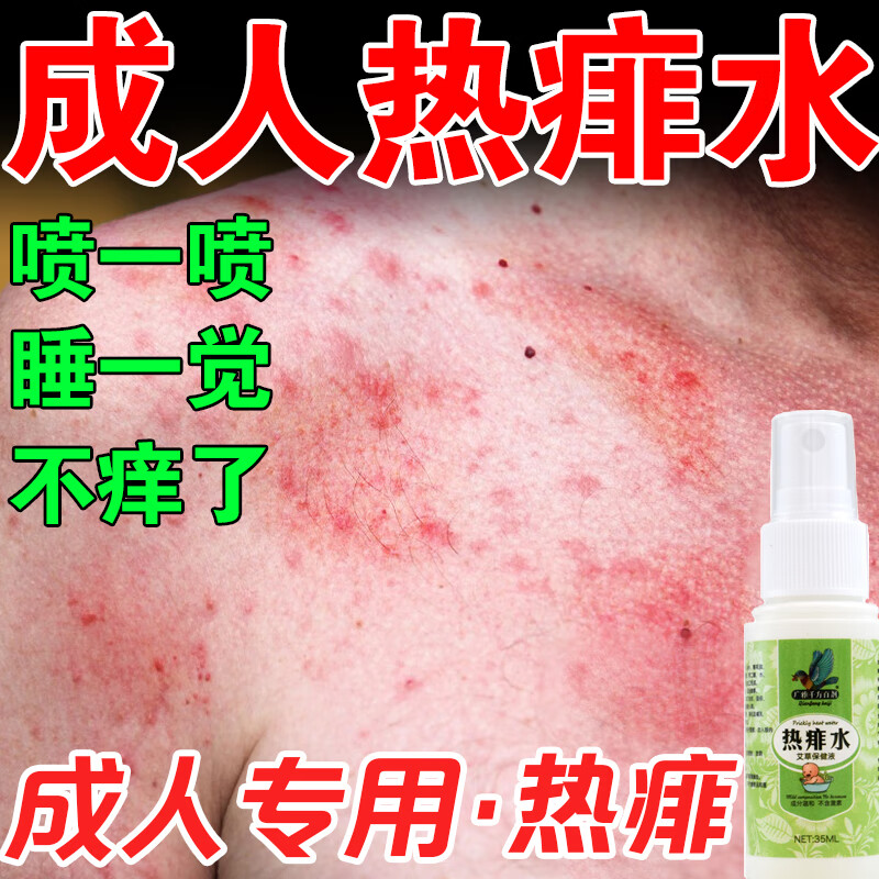 痱子水成人热痱水祛体痱身上痒水成人痱子喷雾红痱膏防热痱子水大人