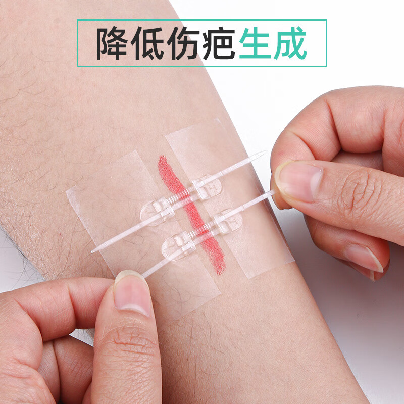 创可贴使用不当截肢_包扎伤口用什么药止血_小孩贴创可贴截肢