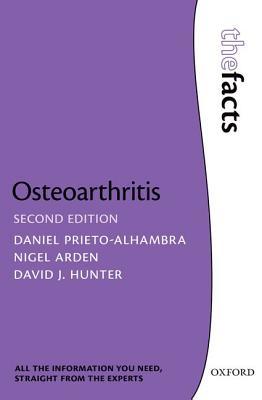 预订osteoarthritis: the facts