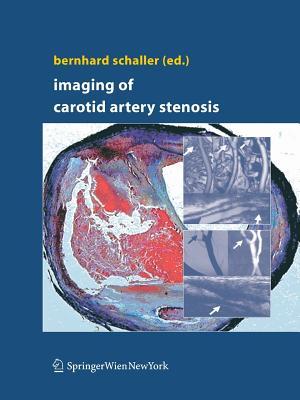 预订Imaging of Carotid Artery Stenosis (2007)