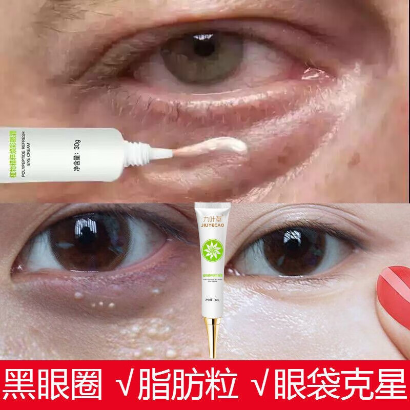 九叶草 眼霜男女士淡化脂肪粒黑眼圈眼袋细纹抬头鱼尾纹提拉紧致眼部