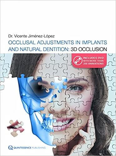 预订 occlusal adjustments in implants and natural dentition:3d