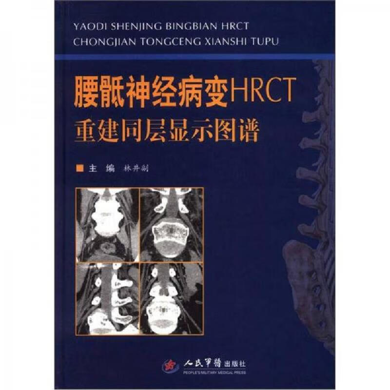 腰骶神经病变HRCT重建同层显示图谱