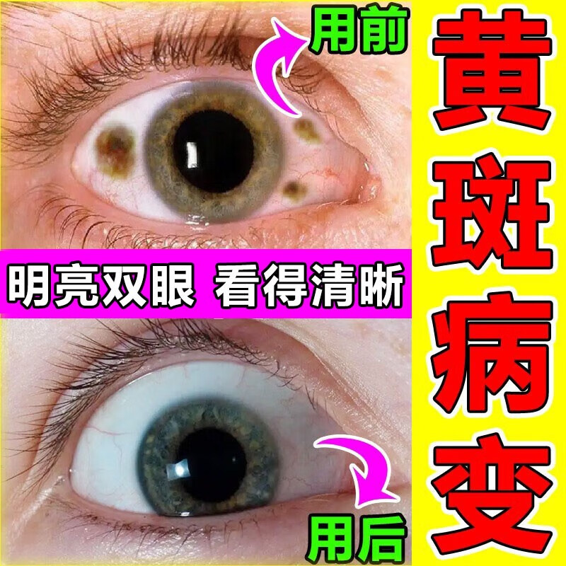 眼睛发黄是什么原因图片