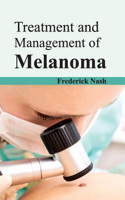 预订Treatment and Management of Melanoma