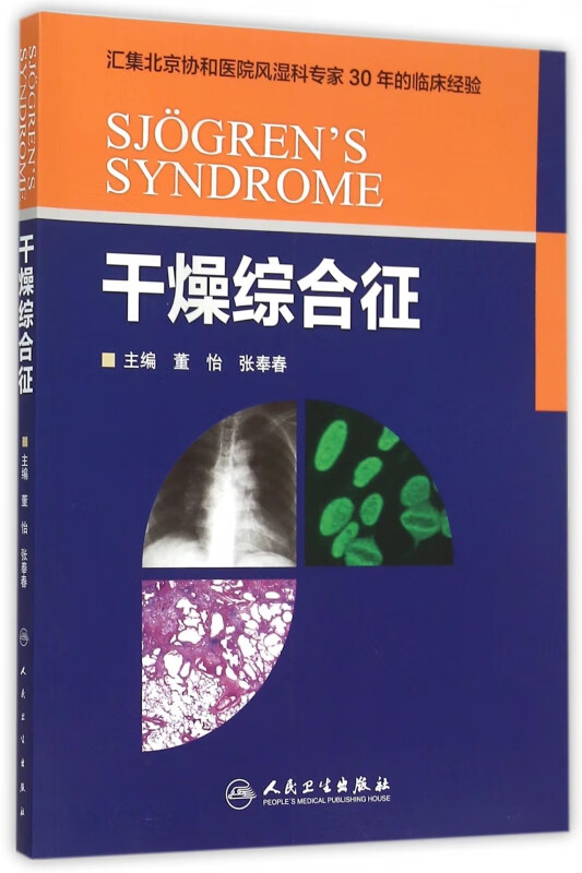 干燥综合征