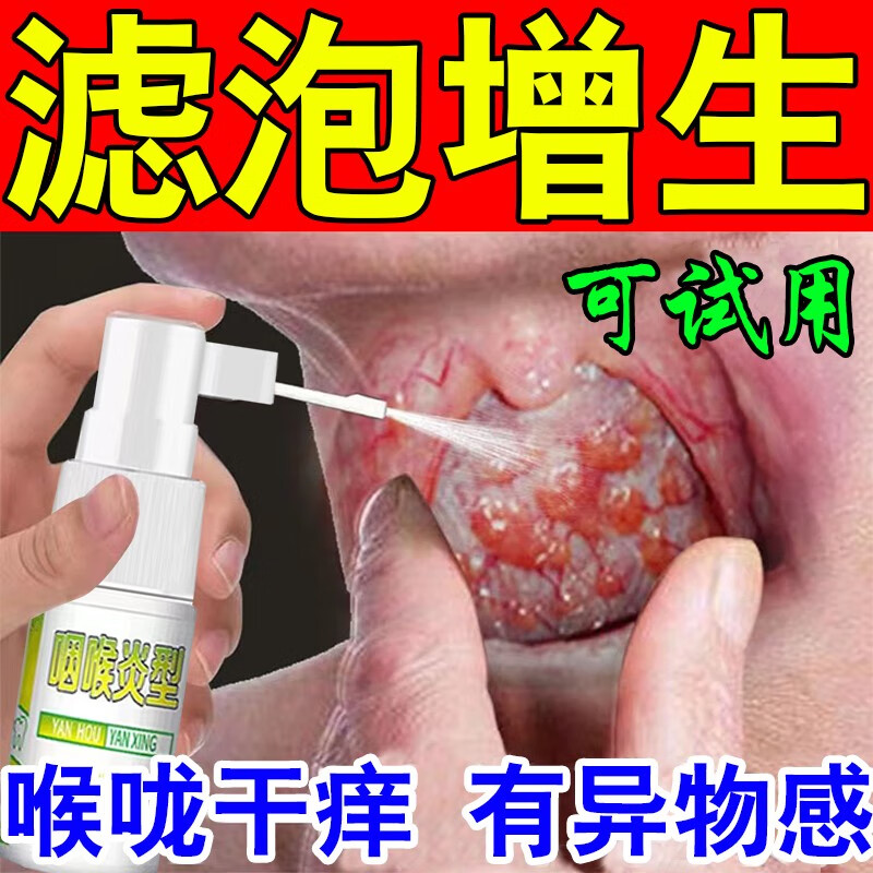 滤泡增生慢性咽炎咽喉壁  淋巴滤泡增生喉咙有痰异物感扁桃体发炎 单