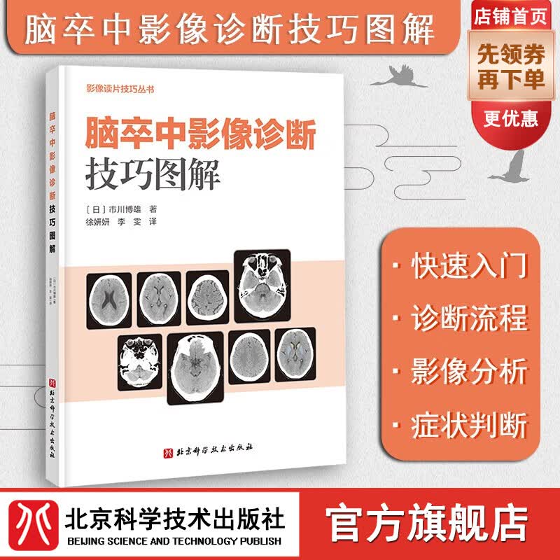 脑卒中影像诊断技巧图解 影像诊断 读片技巧 影像解剖 北京科学技术