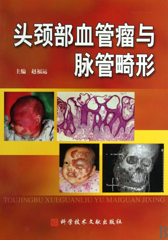 头颈部血管瘤与脉管畸形(精)