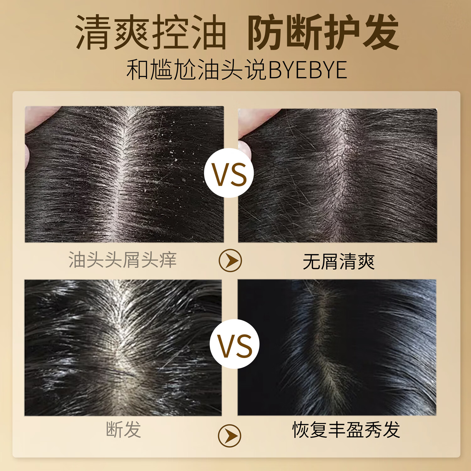 舒芬妮生姜防断发去屑控油洗发乳清爽净屑强韧发根柔顺修护洗发水800ml 生姜头皮净屑洗发乳800ml*1支