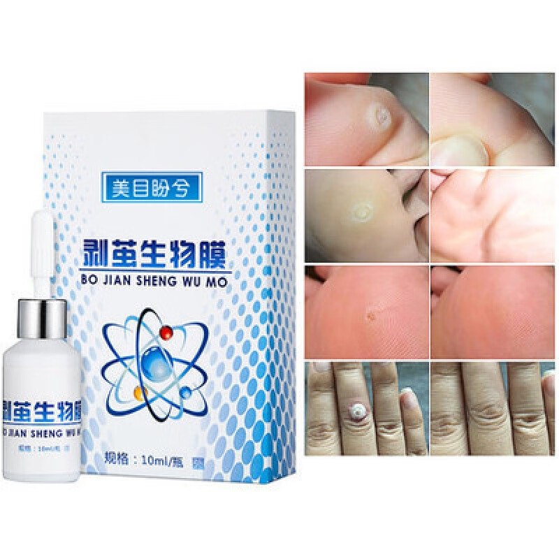 美目盼兮剥茧生物膜鸡眼膏鸡眼贴脚根茧足部手部跖脚底疣脚垫祛茧瘊子刺肉疣寻常趾刺猴成人 1盒