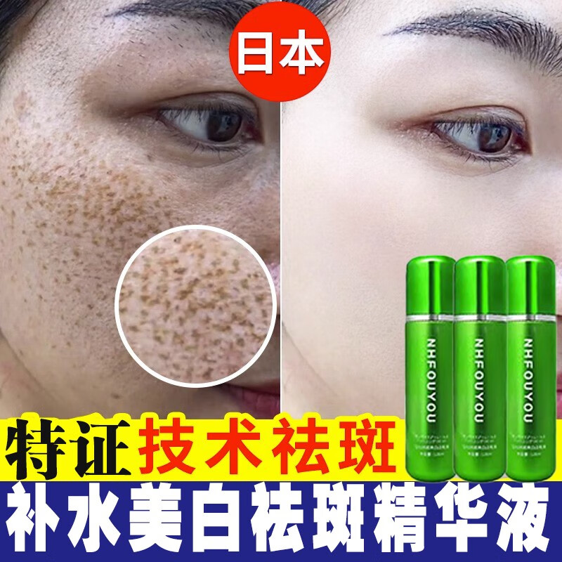 NHFOUYOU美白祛斑精华液淡化晒斑雀斑黄褐斑老年斑提亮肤色收缩毛孔 1瓶【体验装】