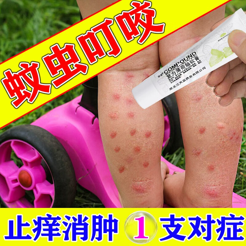复方薄荷脑软膏 28g 蚊虫叮咬止痒消肿止痒药膏治成人儿童婴儿虫咬