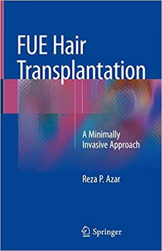 预订fue hair transplantation: a minimally invasive a