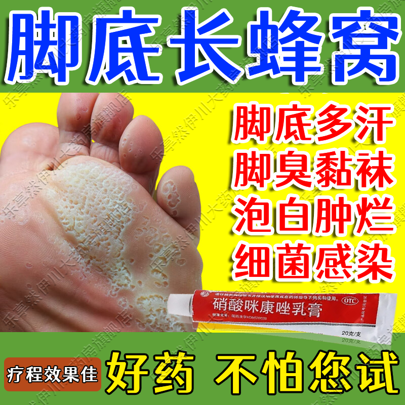 脚气药治痒脱皮烂脚丫真菌感染窝状角质松解症专用药脚气药脚臭脚出汗