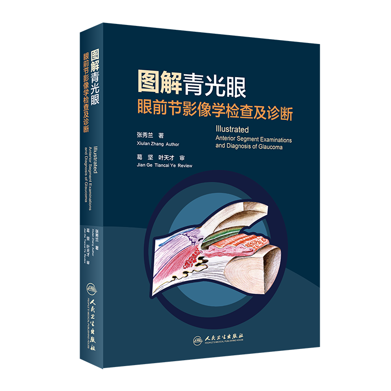 圖解青光眼   眼前節(jié)影像學(xué)檢查及診斷 人民衛(wèi)生出版社