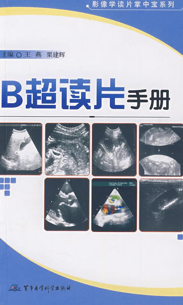 B超读片手册