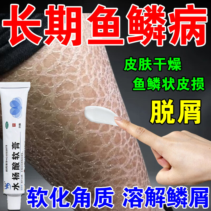 引起的鱼鳞皮蛇皮脱皮掉屑皮肤干燥起皮长褐色鳞屑皮肤外用淡化角质