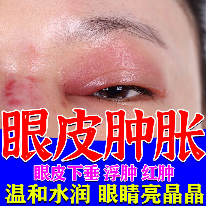 眼睛肿消除肿眼泡浮肿红肿熬夜加班学习眼睛疲劳红血丝消肿去脂肪水肿