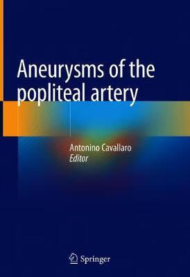 预订 aneurysms of the popliteal artery