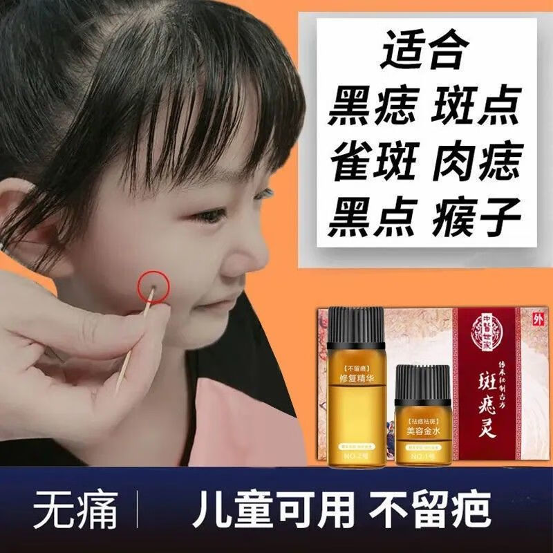 药房直售点痣点斑药水无痕无痛点痣水去痦子痣脱痣去脸上的黑痣去