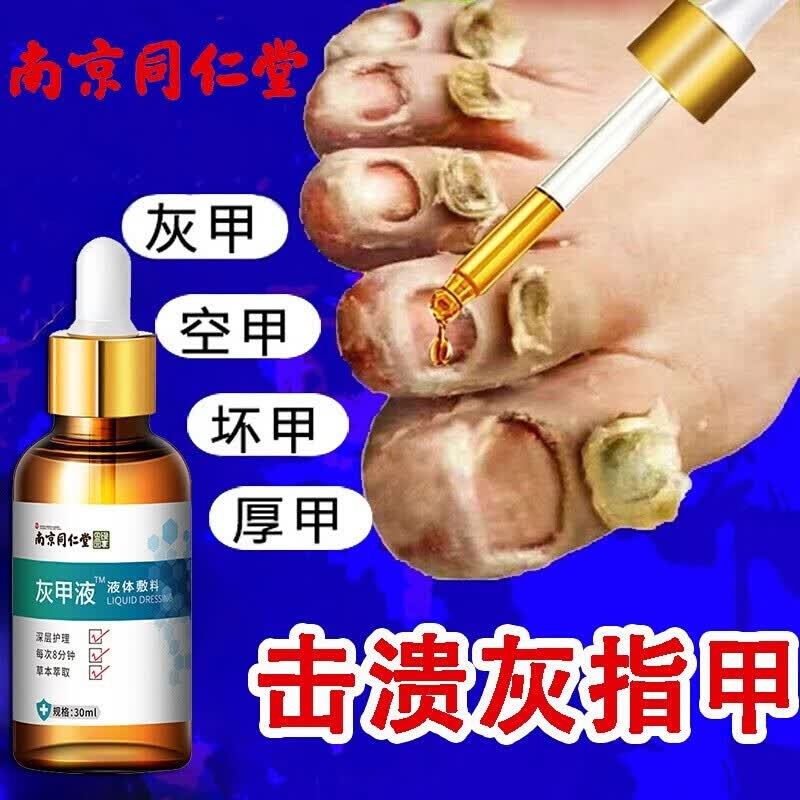 遇见留香灰指甲脱甲膏特1效专1用薬专不包扎不修甲灰指甲液去除水甲本