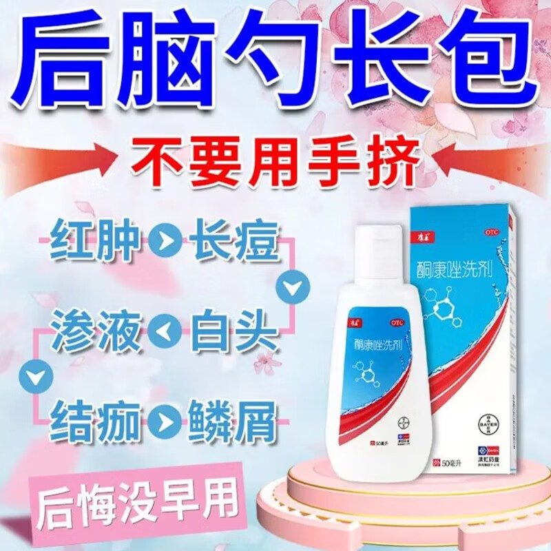 酮康唑洗剂50ml头皮屑严重去头屑药康王溢脂性皮炎洗发水毛囊炎去头皮