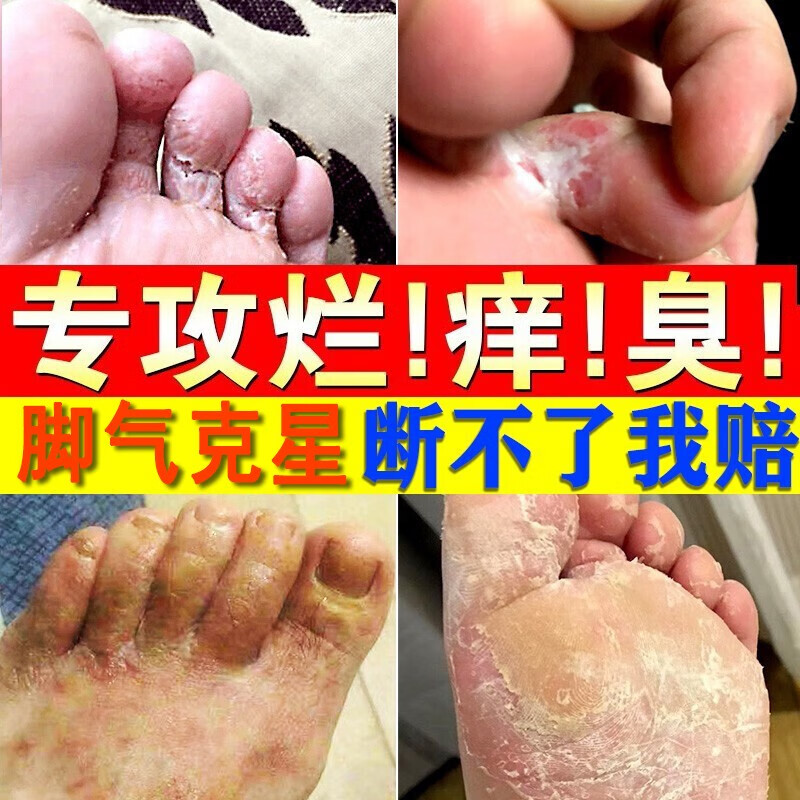 护足霜在线历史价格查询|护足霜价格走势图