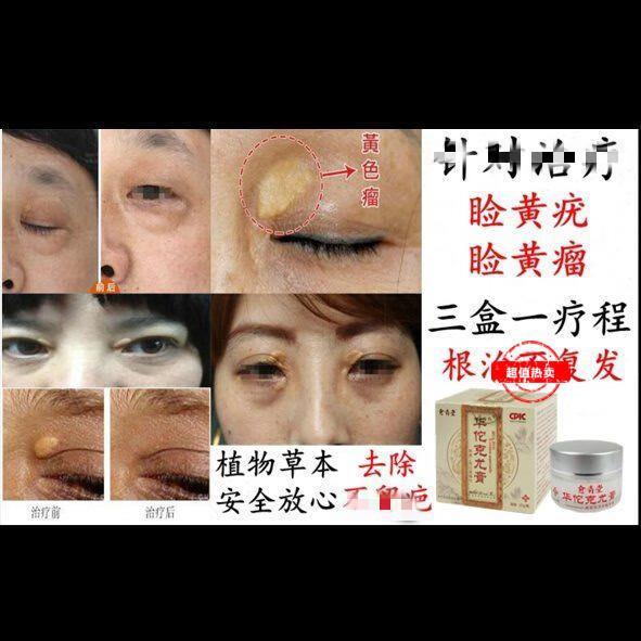 克尤膏跖l疣去尤疣灵病毒疣扁平i疣脸部疣必治去猴子肉粒鸡眼丝状优