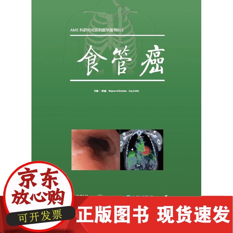 食管癌正版