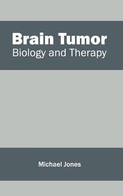 预订Brain Tumor: Biology and Therapy