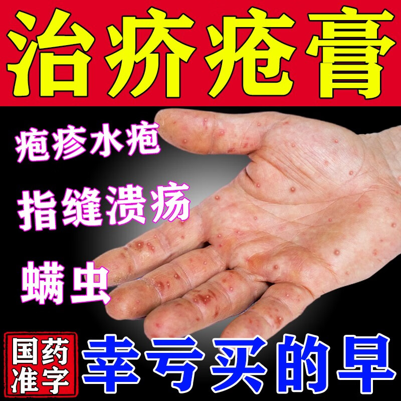 疥疮专药用药膏 硫软膏 疥虫螨虫虱虫药膏治疥疮药膏皮肤瘙痒药外用