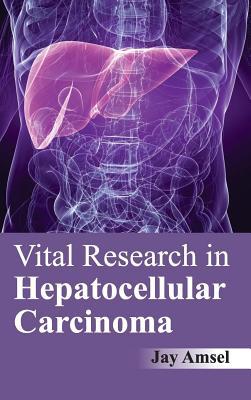 预订Vital Research in Hepatocellular Carcinoma