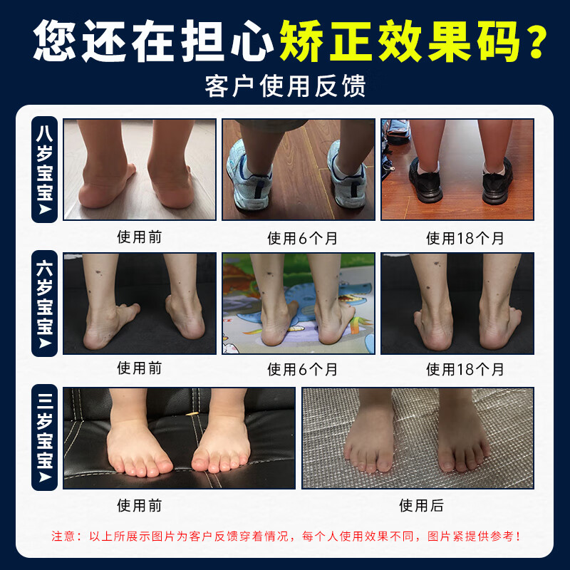 洛崽崽儿童足外翻矫正鞋内外八字纠正脚型内翻外翻扁平足高帮运动鞋秋冬 粉色 加绒 36 内长22.5cm