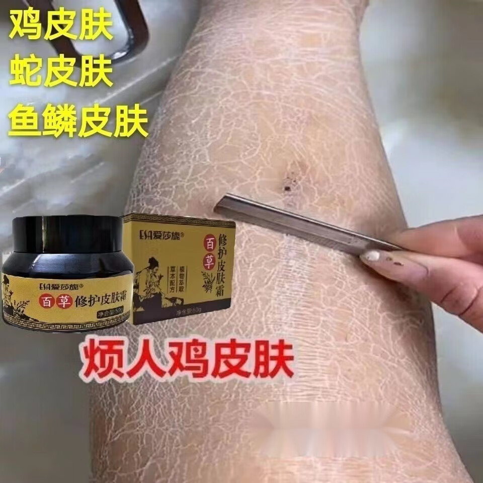 鸡皮疙瘩的鸡(鸡皮疙瘩鸡皮疙瘩小苹果) 鸡皮疙瘩的鸡(鸡皮疙瘩鸡皮疙瘩小苹果)