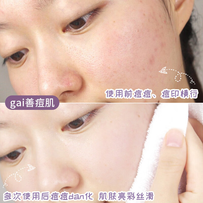 别挤！让毛孔排出脏东西 固体面膜清洁泥膜收缩毛孔男女 固体面膜【绿茶1+茄子1】