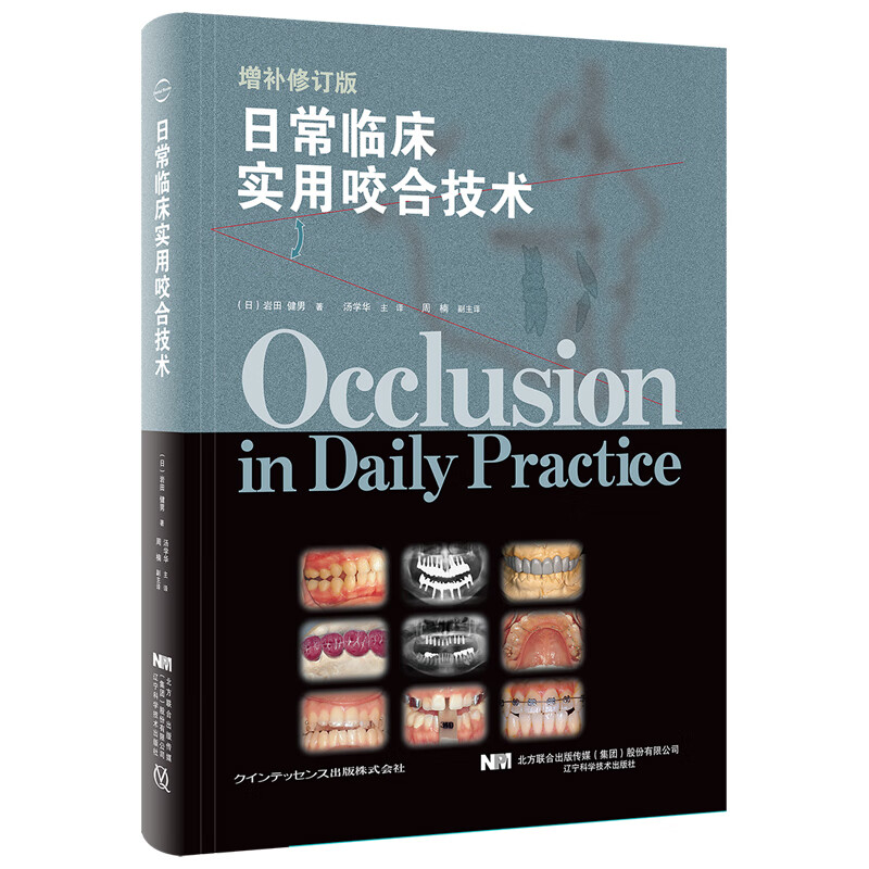 日常临床实用咬合技术