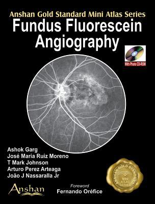 预订 fundus fluorescein angiography [with mini cdrom