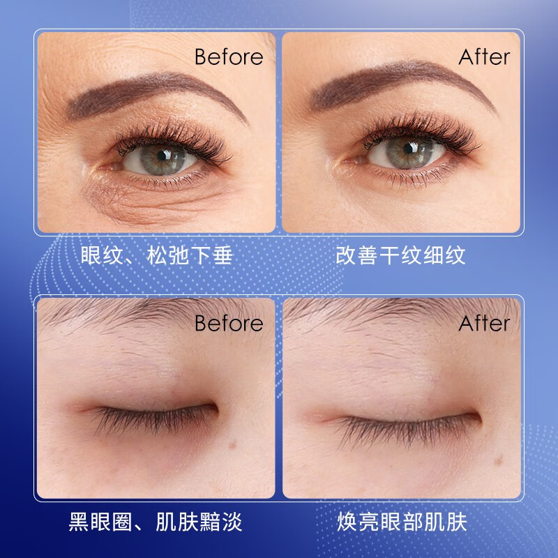 梦希蓝抗皱眼部精华油紧致眼周淡纹细纹按摩滚珠霜 1瓶装【8ml】