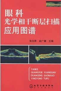 眼科光学相干断层扫描应用图谱 张汉君,赵广健主编 9787122020642